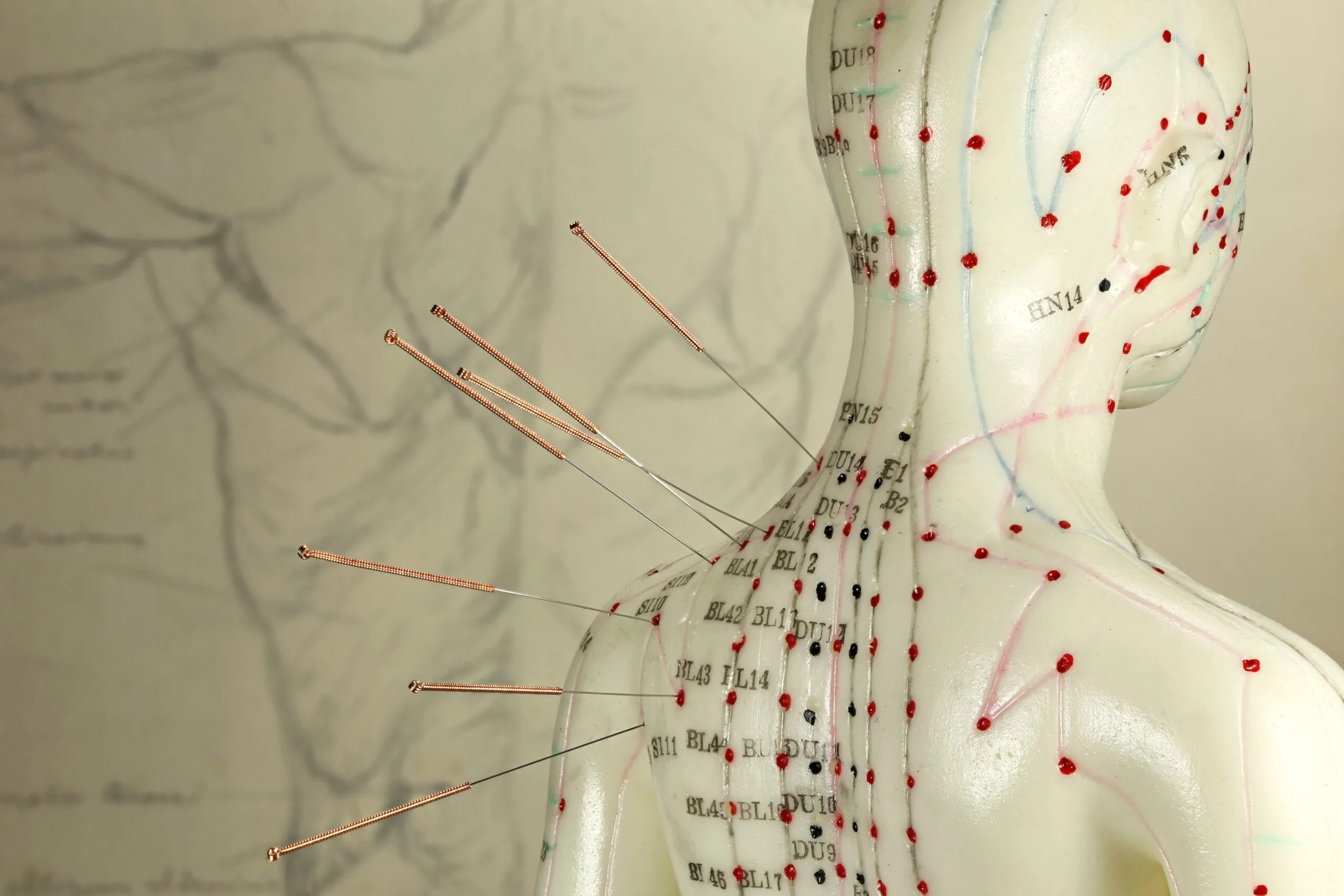 female acupuncture model