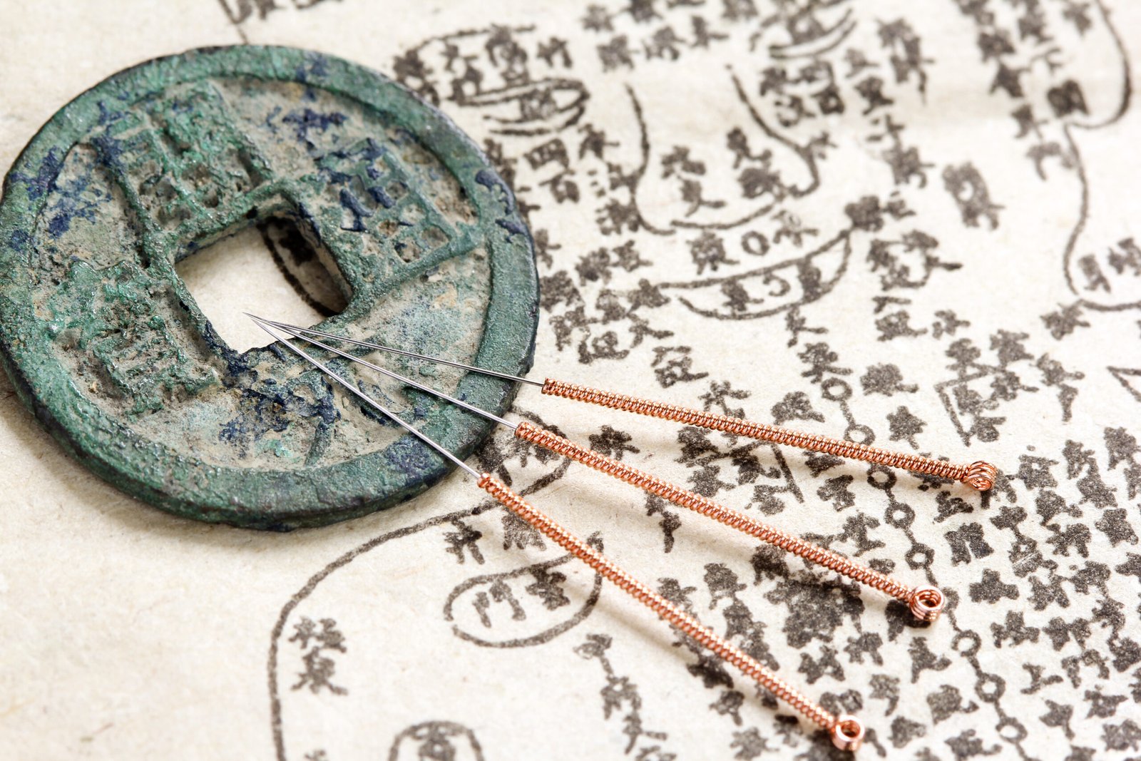 Acupuncture,,And,Ancient,Medicine,Illustration,Showing,Acupuncture,Points,On